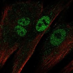 Invitrogen EBF2 Polyclonal Antibody 100 &mu;L | Buy Online | Invitrogen&trade; | Fisher Scientific