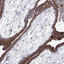 Invitrogen MMAA Polyclonal Antibody 100 &mu;L; Unconjugated:Antibodies,