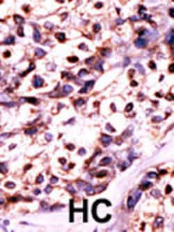 Invitrogen UCK2 Polyclonal Antibody 400 &mu;L; Unconjugated:Antibodies,