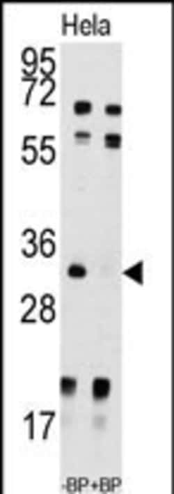 Invitrogen UCK2 Polyclonal Antibody 400 &mu;L; Unconjugated:Antibodies,