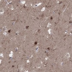 Invitrogen PLCL2 Polyclonal Antibody 100 &mu;L; Unconjugated:Antibodies,