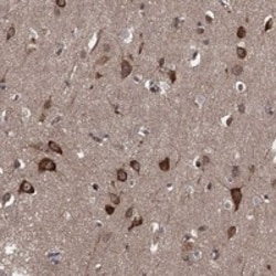 Invitrogen HABP4 Polyclonal Antibody 100 &mu;L; Unconjugated:Antibodies,