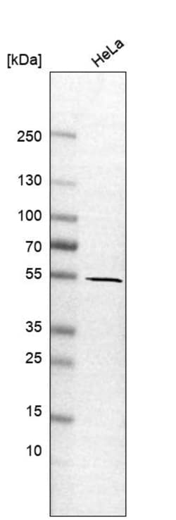 Invitrogen GLIS2 Polyclonal Antibody 100 &mu;L | Buy Online | Invitrogen&trade; | Fisher Scientific