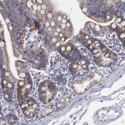 Invitrogen GCAT Polyclonal Antibody 100 &mu;L; Unconjugated:Antibodies,