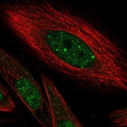 Invitrogen HIVEP1 Polyclonal Antibody 100 &mu;L; Unconjugated:Antibodies,