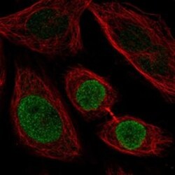 Invitrogen ZNF354C Polyclonal Antibody 100 &mu;L; Unconjugated:Antibodies,