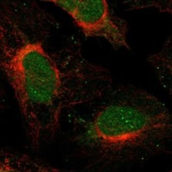 Invitrogen SFMBT2 Polyclonal Antibody 100 &mu;L; Unconjugated:Antibodies,