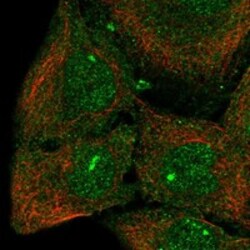 Invitrogen CPEB3 Polyclonal Antibody 100 &mu;L; Unconjugated:Antibodies,
