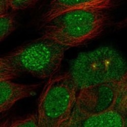Invitrogen SENP7 Polyclonal Antibody 100 μL; Unconjugated:Antibodies,