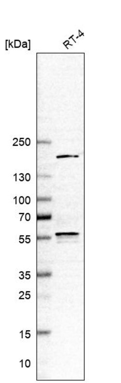 Invitrogen ETV3 Polyclonal Antibody 100 &mu;L; Unconjugated:Antikroppar