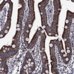 Invitrogen RCE1 Polyclonal Antibody 100 &mu;L; Unconjugated:Antibodies,