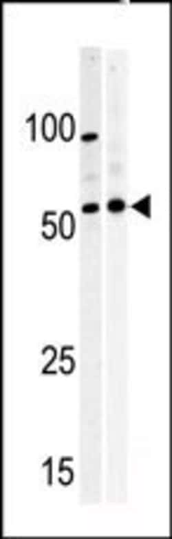 Invitrogen PKMYT1 Polyclonal Antibody 400 &mu;L; Unconjugated:Antibodies,