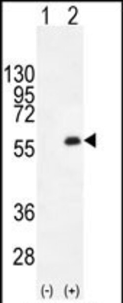 Invitrogen PKMYT1 Polyclonal Antibody 400 &mu;L; Unconjugated:Antibodies,