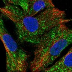 Invitrogen METTL27 Polyclonal Antibody 100 &mu;L; Unconjugated:Antibodies,