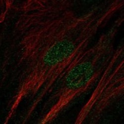 Invitrogen SALL1 Polyclonal Antibody 100 &mu;L; Unconjugated:Antibodies,