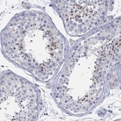 Invitrogen CCDC176 Polyclonal Antibody 100 &mu;L | Buy Online | Invitrogen&trade; | Fisher Scientific