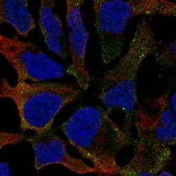 Invitrogen GALNT16 Polyclonal Antibody 100 μL; Unconjugated:Antibodies,