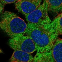 Invitrogen ZBTB45 Polyclonal Antibody 100 &mu;L; Unconjugated:Antibodies,