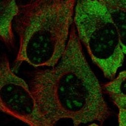 Invitrogen DOHH Polyclonal Antibody 100 μL; Unconjugated:Antibodies,