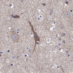 Invitrogen Clavesin-1 Polyclonal Antibody 100 &mu;L; Unconjugated:Antibodies,
