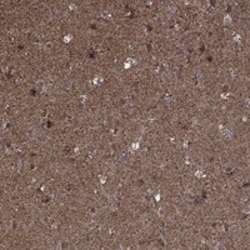 Invitrogen MAP1 Polyclonal Antibody 100 &mu;L; Unconjugated:Antibodies,