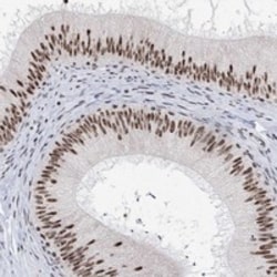 Invitrogen USP39 Polyclonal Antibody 100 &mu;L; Unconjugated:Antibodies,
