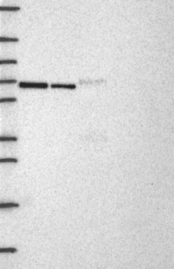 Invitrogen USP39 Polyclonal Antibody 100 &mu;L; Unconjugated:Antibodies,
