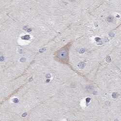 Invitrogen PCDH11X Polyclonal Antibody 100 &mu;L | Buy Online | Invitrogen&trade; | Fisher Scientific