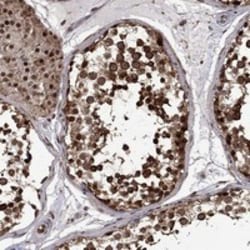Invitrogen KPNA3 Polyclonal Antibody 100 μL; Unconjugated:Antibodies,