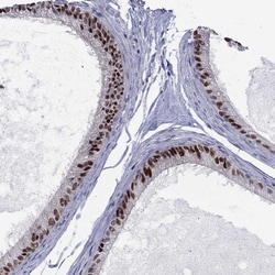 Invitrogen ZNHIT3 Polyclonal Antibody 100 &mu;L; Unconjugated:Antibodies,