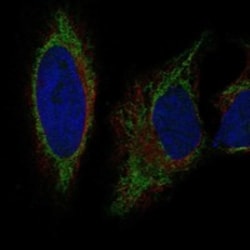 Invitrogen GRK7 Polyclonal Antibody 100 μL; Unconjugated:Antibodies,