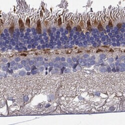 Invitrogen GRK7 Polyclonal Antibody 100 μL; Unconjugated:Antibodies,