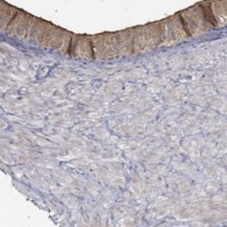 Invitrogen EMILIN3 Polyclonal Antibody 100 &mu;L; Unconjugated:Antibodies,