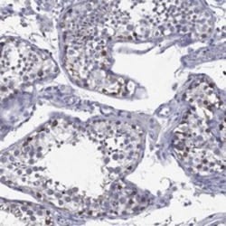 Invitrogen C19orf18 Polyclonal Antibody 100 &mu;L; Unconjugated:Antibodies,