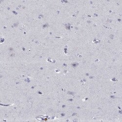 Invitrogen CD103 (Integrin alpha E) Polyclonal Antibody 100 &mu;L; Unconjugated:Antibodies,