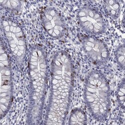 Invitrogen CD103 (Integrin alpha E) Polyclonal Antibody 100 &mu;L; Unconjugated:Antibodies,