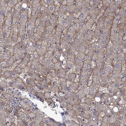 Invitrogen ZIP14 Polyclonal Antibody 100 &mu;L; Unconjugated:Antibodies,
