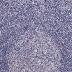 Invitrogen ZIP14 Polyclonal Antibody 100 &mu;L; Unconjugated:Antibodies,