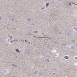 Invitrogen ABCG4 Polyclonal Antibody 100 &mu;L | Buy Online | Invitrogen&trade; | Fisher Scientific