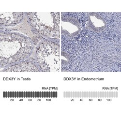 Invitrogen DDX3Y Polyclonal Antibody 100 &mu;L; Unconjugated:Antibodies,