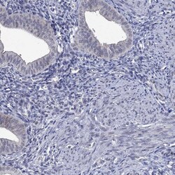 Invitrogen DDX3Y Polyclonal Antibody 100 &mu;L; Unconjugated:Antibodies,
