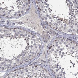 Invitrogen DDX3Y Polyclonal Antibody 100 &mu;L; Unconjugated:Antibodies,