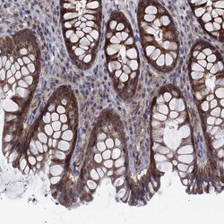 Invitrogen SLC35F2 Polyclonal Antibody 100 &mu;L; Unconjugated:Antibodies,
