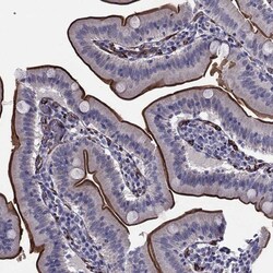 Invitrogen&trade;&nbsp;ANKS4B Polyclonal Antibody