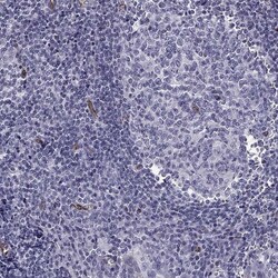 Invitrogen&trade;&nbsp;ANKS4B Polyclonal Antibody