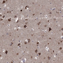 Invitrogen SLC2A13 Polyclonal Antibody 100 &mu;L; Unconjugated:Antibodies,