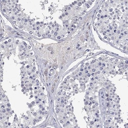 Invitrogen EAAC1 Polyclonal Antibody 100 &mu;L; Unconjugated:Antibodies,