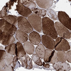 Invitrogen NDUFC1 Polyclonal Antibody 100 &mu;L | Buy Online | Invitrogen&trade; | Fisher Scientific