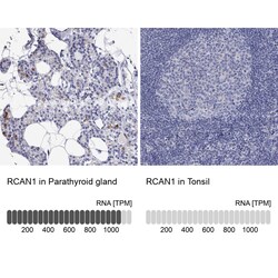 Invitrogen RCAN1 Polyclonal Antibody 100 &mu;L; Unconjugated:Antibodies,