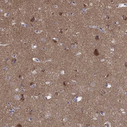 Invitrogen ATP6V1G2 Polyclonal Antibody 100 &mu;L; Unconjugated:Antibodies,